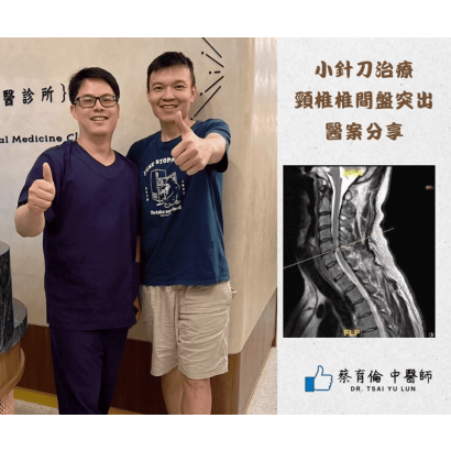 頸椎椎間盤突出 - 醫案一