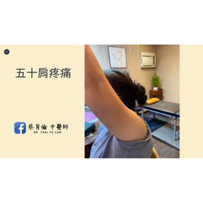 五十肩醫案分享