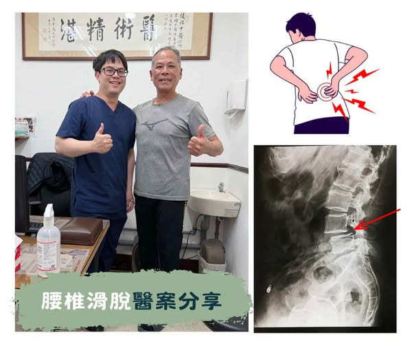 針刀醫案分享照片