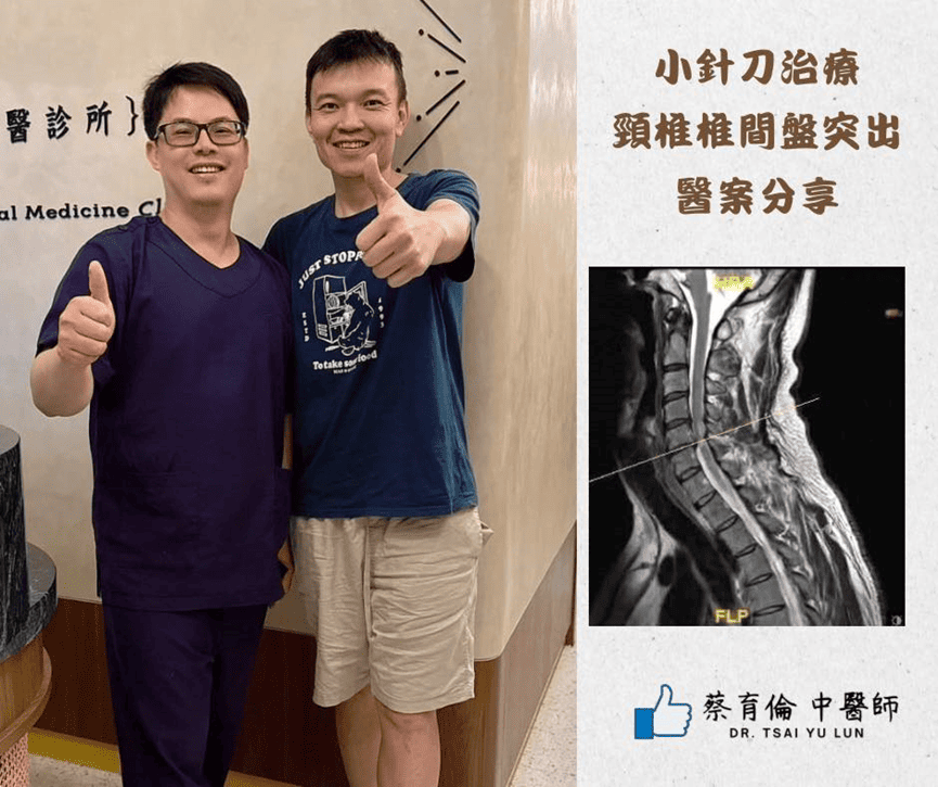 頸椎椎間盤突出治療紀錄