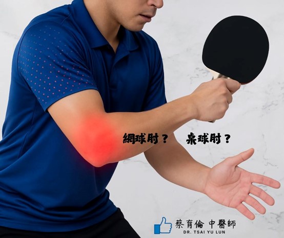 網球肘治療紀錄