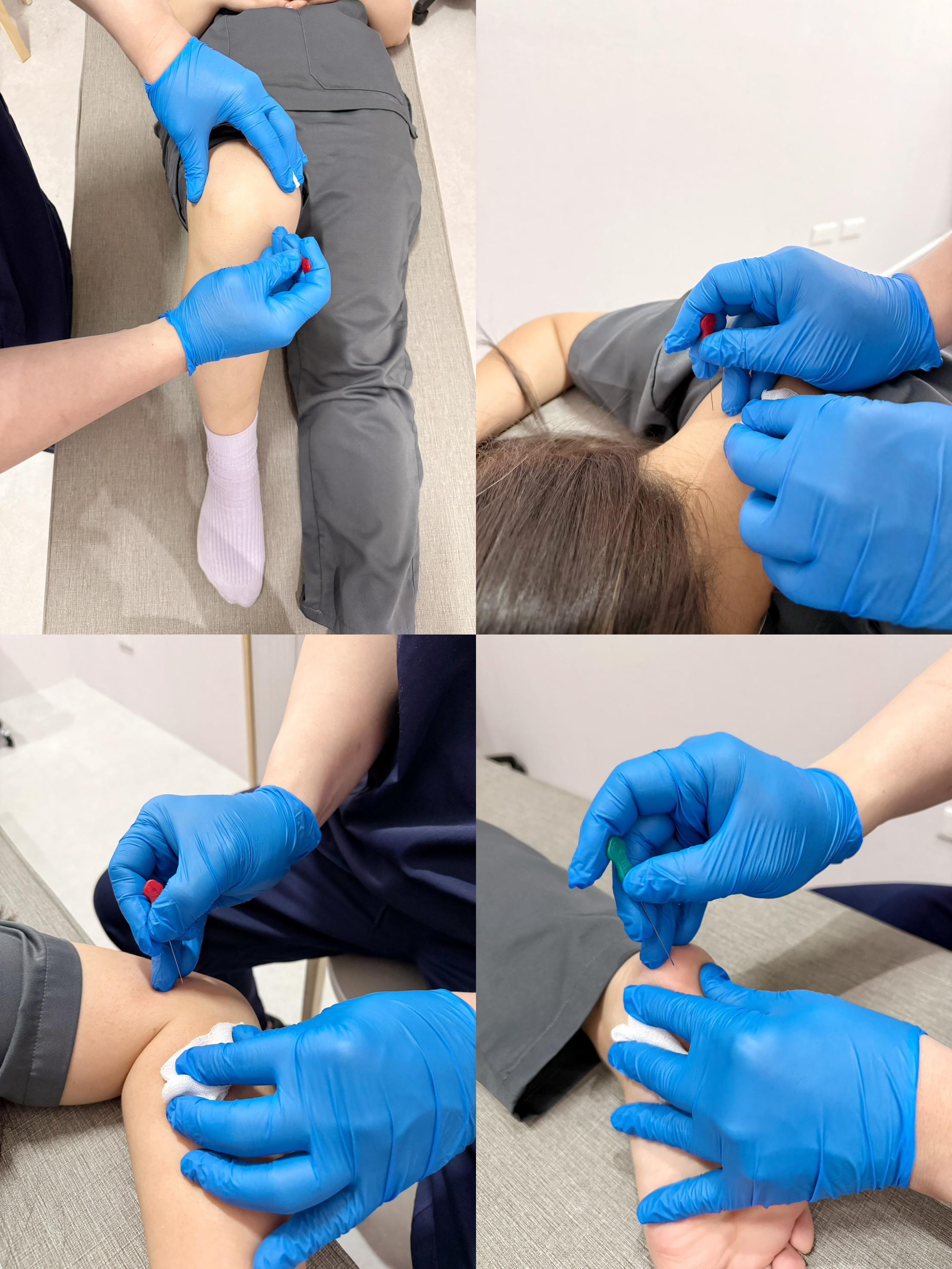 小針刀治療適應症示意圖