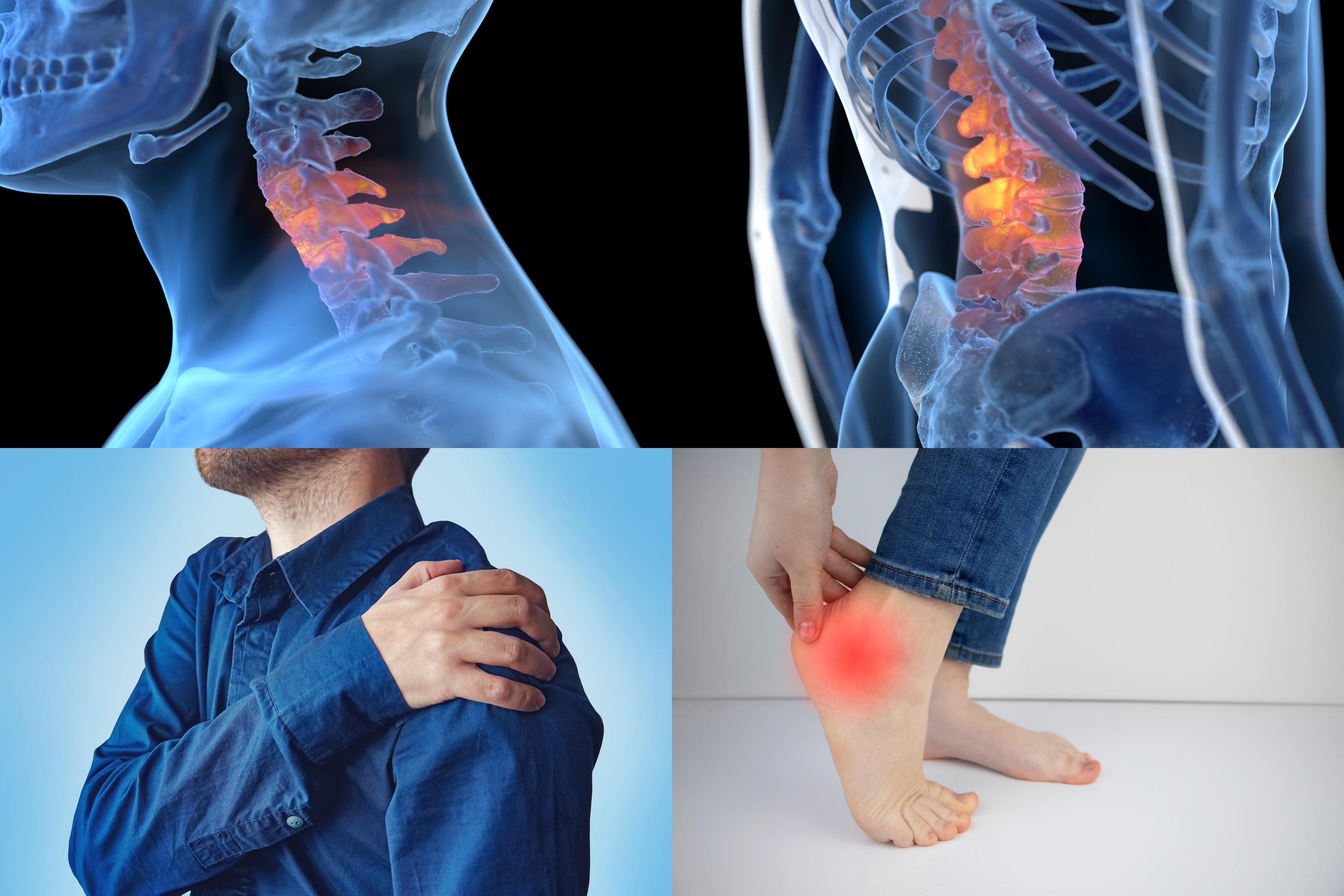 針刀適應症示意圖